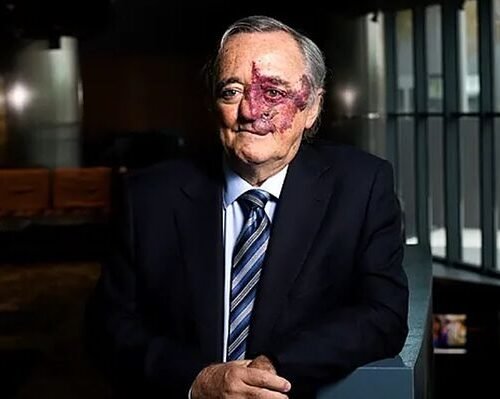 Barbacid blindó con un contrato «inhabitual» al gerente acusado del desfalco de 25 millones de la lucha contra el cáncer en el CNIO