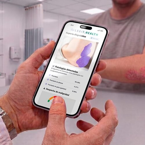 La inteligencia artificial nacida en España que mejora el diagnóstico dermatológico